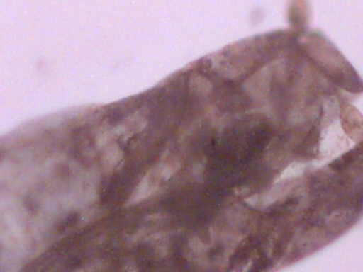 microinvertebrato? Copepode - con uova?